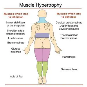 Layer Syndrome